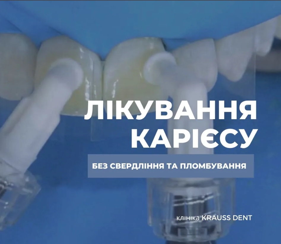 стоматологічна клініка KRAUSS DENTAL
